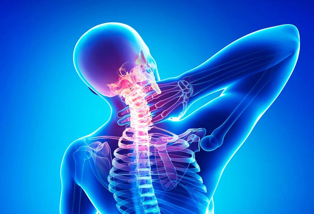 L'ostéochondrose de la colonne vertébrale est une maladie courante qui nécessite un traitement. 