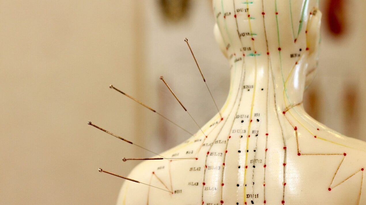 acupuncture pour l'ostéochondrose cervicale