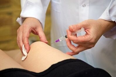 injections pour le traitement de l'arthrose de l'articulation du genou