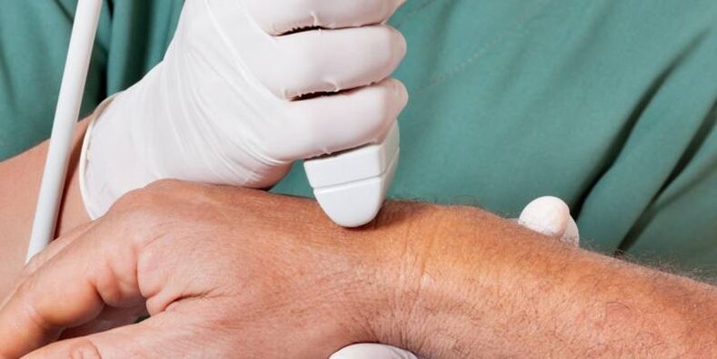 arthrite comme causes de douleur dans les articulations des doigts